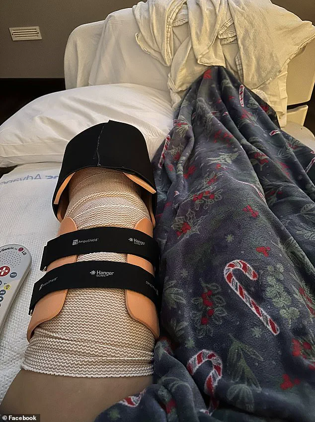 Amanda Mears: 'Utterly Blindsided' by Pit Bull Attack That Left Her with Life-Altering Injuries