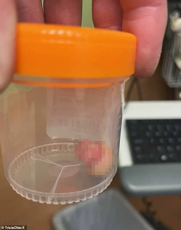 Exclusive Access to Graphic Details of Officer's Injury Amid Minneapolis Protests