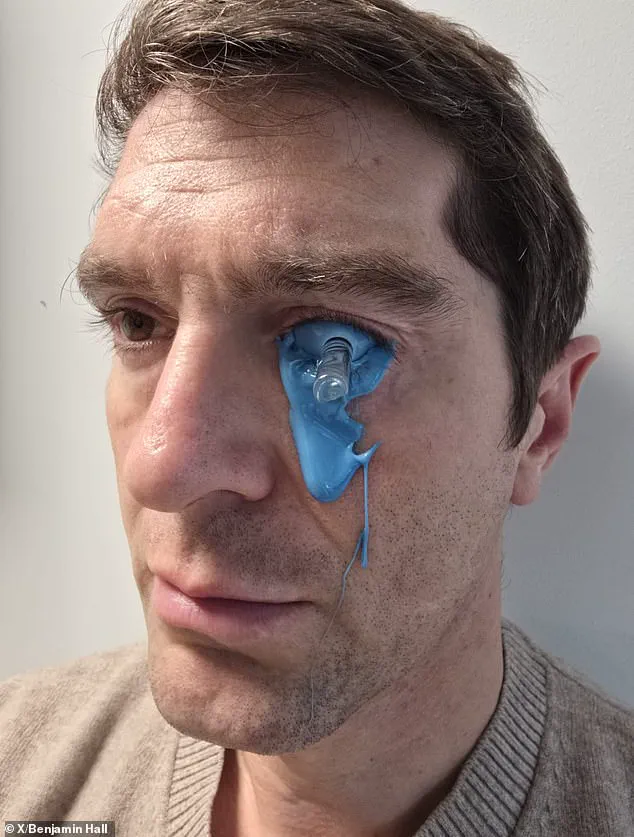 Graphic Image of Fox News Journalist's Recovery from Ukraine War Injuries Sparks Public Reaction