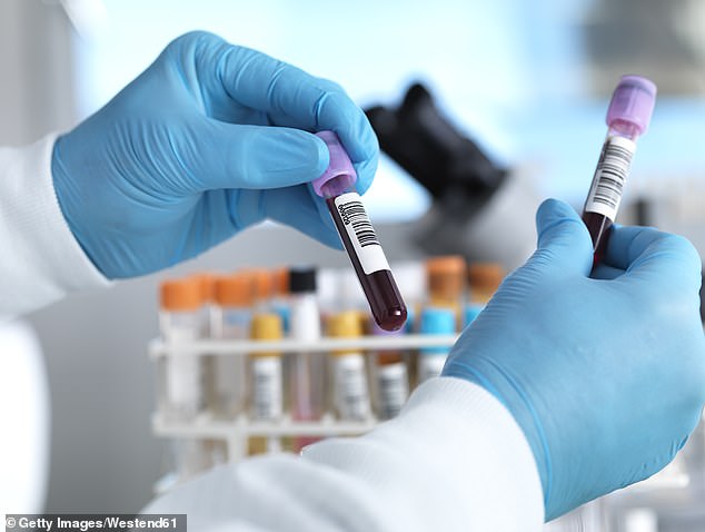 New Galleri blood test could save 30,000 lives annually by detecting cancer early.